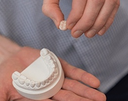 Dental Implants in Noosa